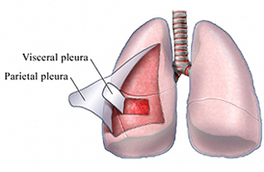Pleura of the Lungs (Lung Lining)